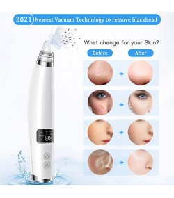 BESTOPE Blackhead Remover Pore Vacuum