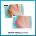 O’Keeffe’s Healthy Feet Foot Cream – Extremely Dry, Cracked Feet – Jar