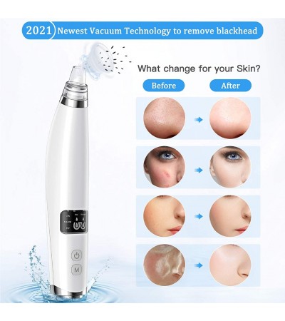 BESTOPE Blackhead Remover Pore Vacuum