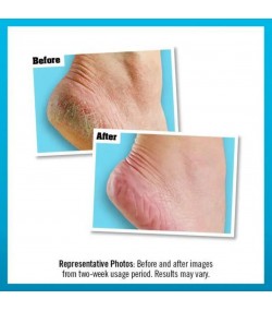 O’Keeffe’s Healthy Feet Foot Cream, Extremely Dry, Cracked Feet